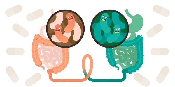 腸道健康食物大挑戰:20題測出你的益生菌智商