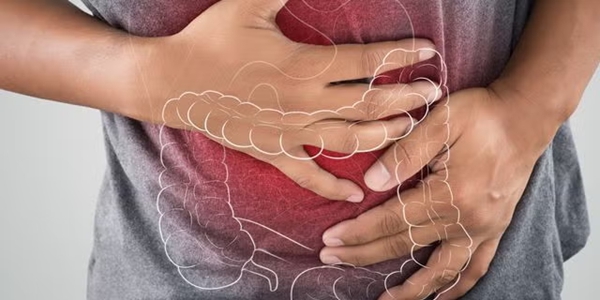 腸活クイズ：あなたのプロバイオティクス知識をチェック！